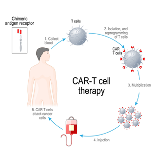 CAR-T Cell Therapy