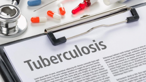 India Needs Innovative Strategies to Eliminate Tuberculosis (TB)