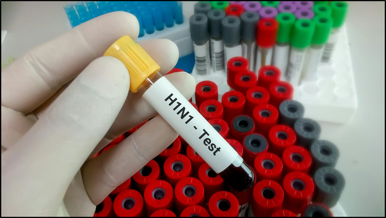 H1N1 Alert: Why ICMR Says There Is No Cause for Panic