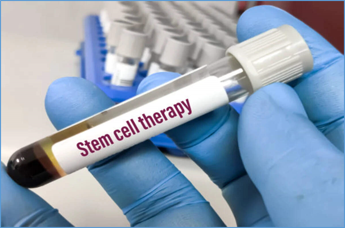 Stem Cell Therapy for Autism