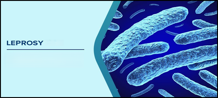 What is Leprosy (Hansen’s Disease)?